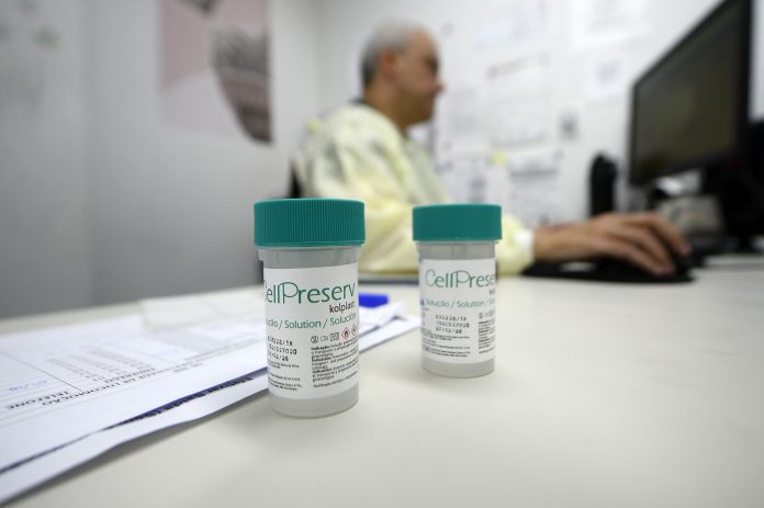 teste hiv