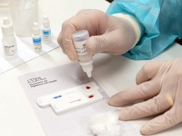 Dezembro Vermelho reforça prevenção e diagnóstico das ISTs em Minas Gerais TESTE AIDS