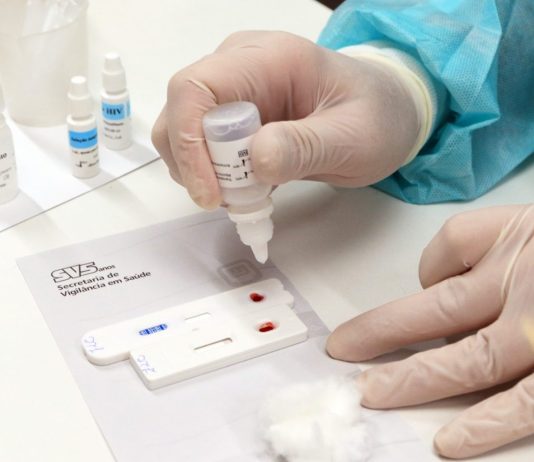 Dezembro Vermelho reforça prevenção e diagnóstico das ISTs em Minas Gerais TESTE AIDS